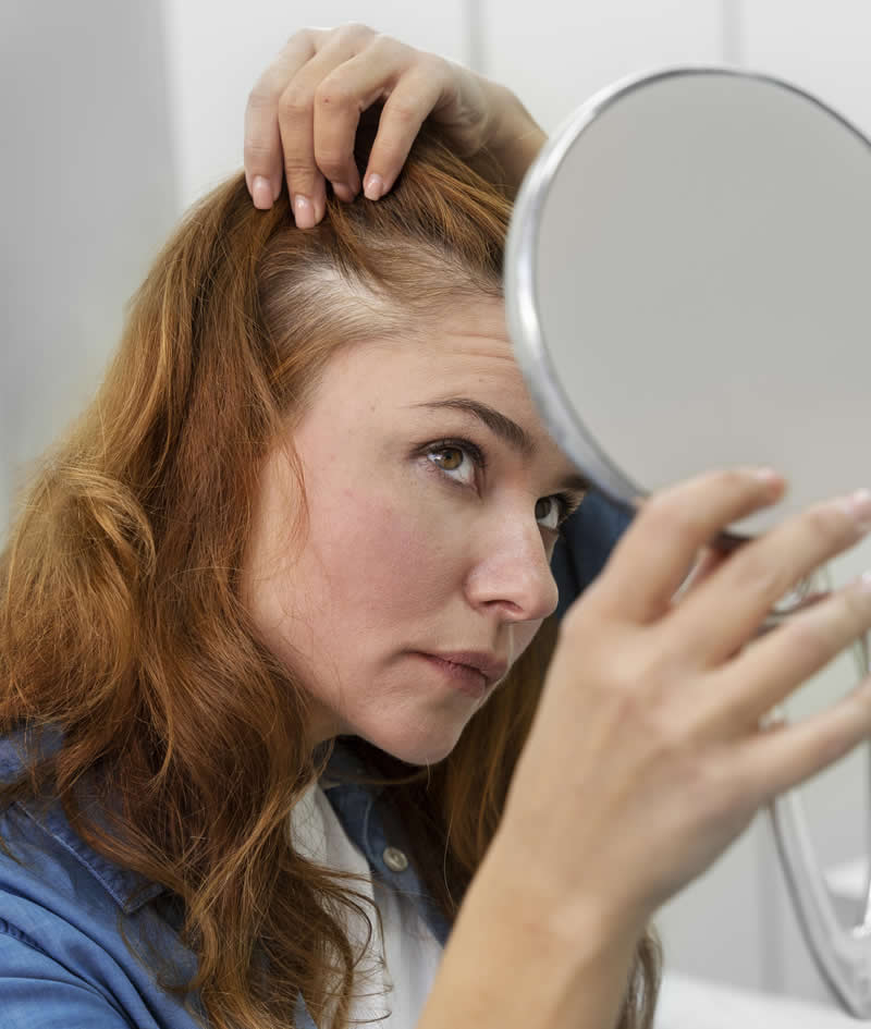 Mald alopecia
